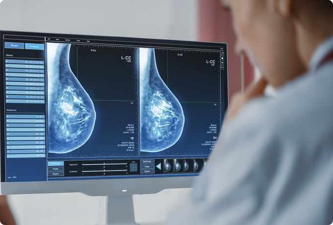 trusted-cancer-care Doctor reviewing MRIs